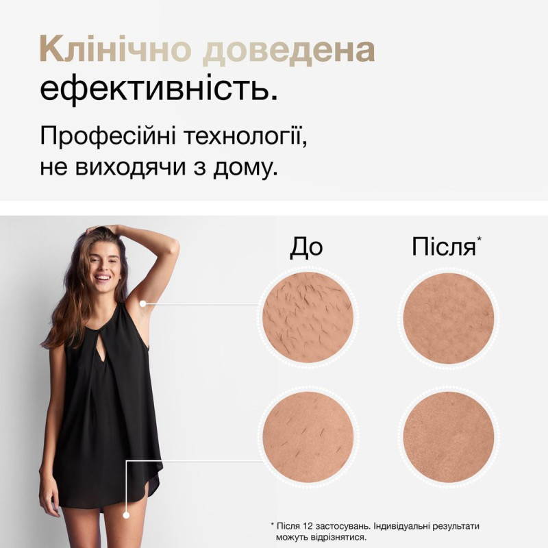 Фотоепілятор для дому Braun Silk-expert Pro 5 PL5146